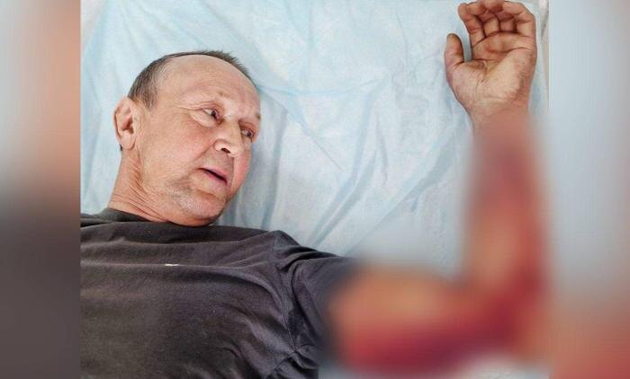 Житель Татарстана, который чуть не умер из-за укуса змеи. Обложка © Telegram / Mash Iptash