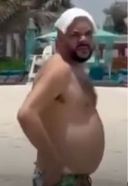 -2