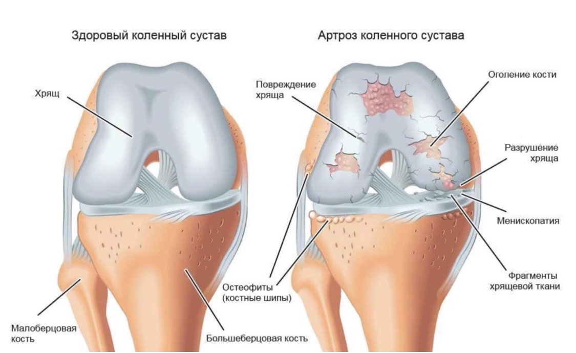 Классически неправильная картинка