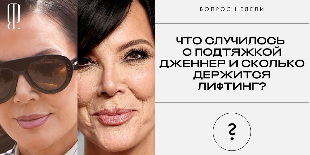 Год назад казалось, что фэйс-лифтинг научился «‎отменять» старение — по крайней мере, Крис Дженнер после операции у Стивена Ливайна стала