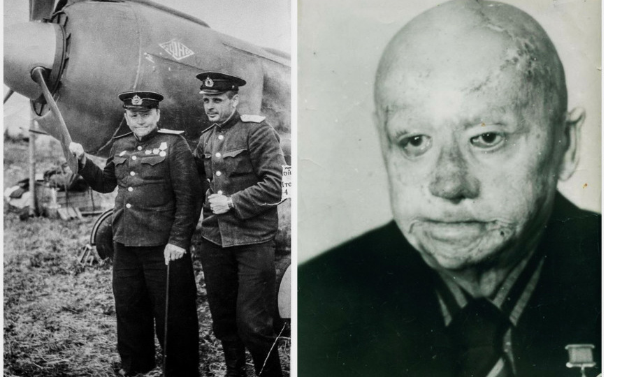 «Ни о каких полётах нет и речи,вы же, извините – инвалид!»: через секунду лётчик без ног и лица сделал то, что сразу отменило вердикт ВВК
