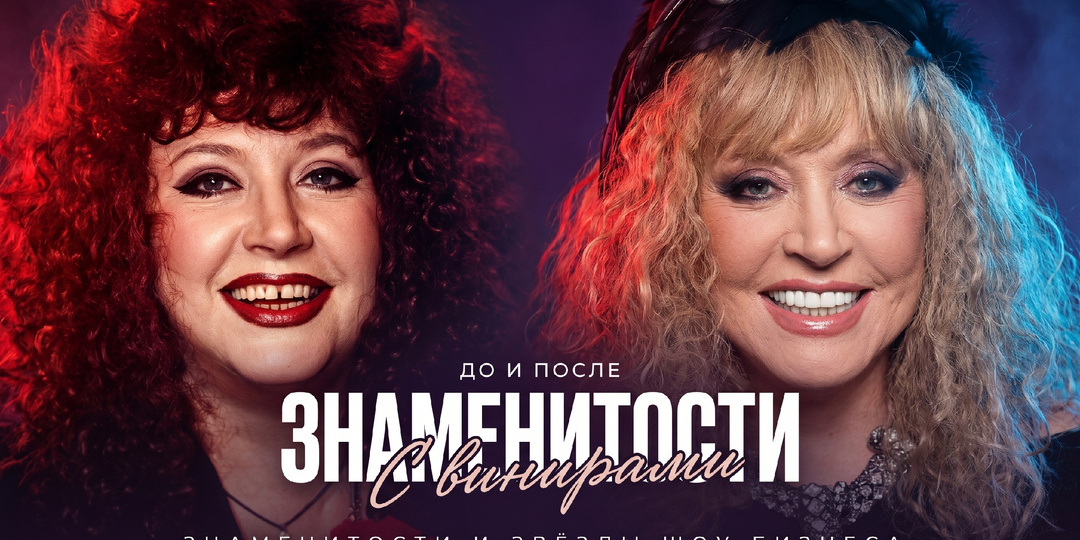 Улыбка на миллион: 10 преображений звезд, которые изменили всё