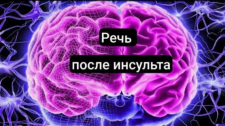 Речь после инсульта
