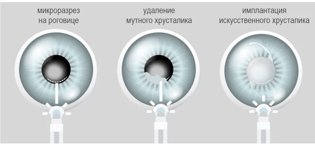 Изображение из Яндекс картинки 