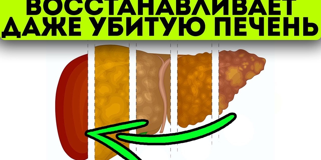 Как ОЖИВИТЬ ПЕЧЕНЬ за 10 дней и избавиться от ЖИРОВОЙ ПЕЧЕНИ навсегда