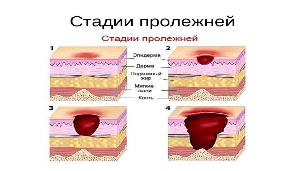 Картинка из просторов Интернета