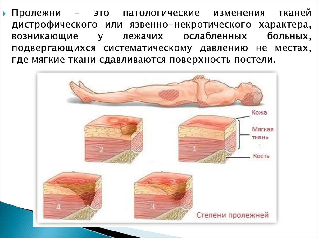 Картинка из просторов Интернета