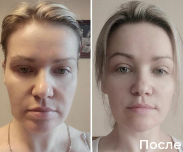 До и После программы "DIVAПреображение 5D"