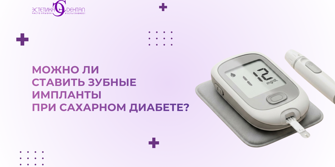 Имплантация зубов при сахарном диабете: когда можно и при каких условиях безопасно