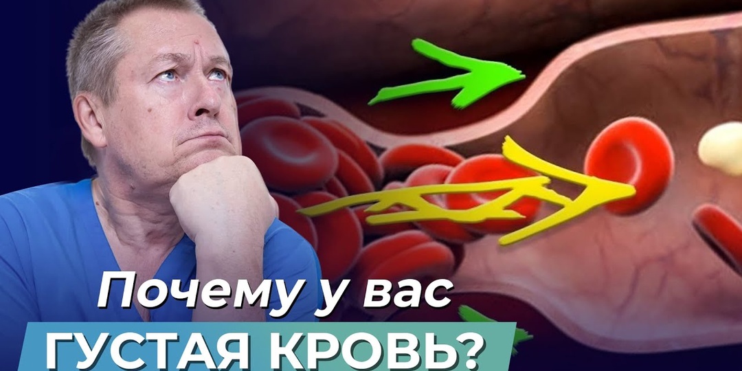 ГУСТАЯ КРОВЬ? Этот сигнал есть у 8 из 10 после 55