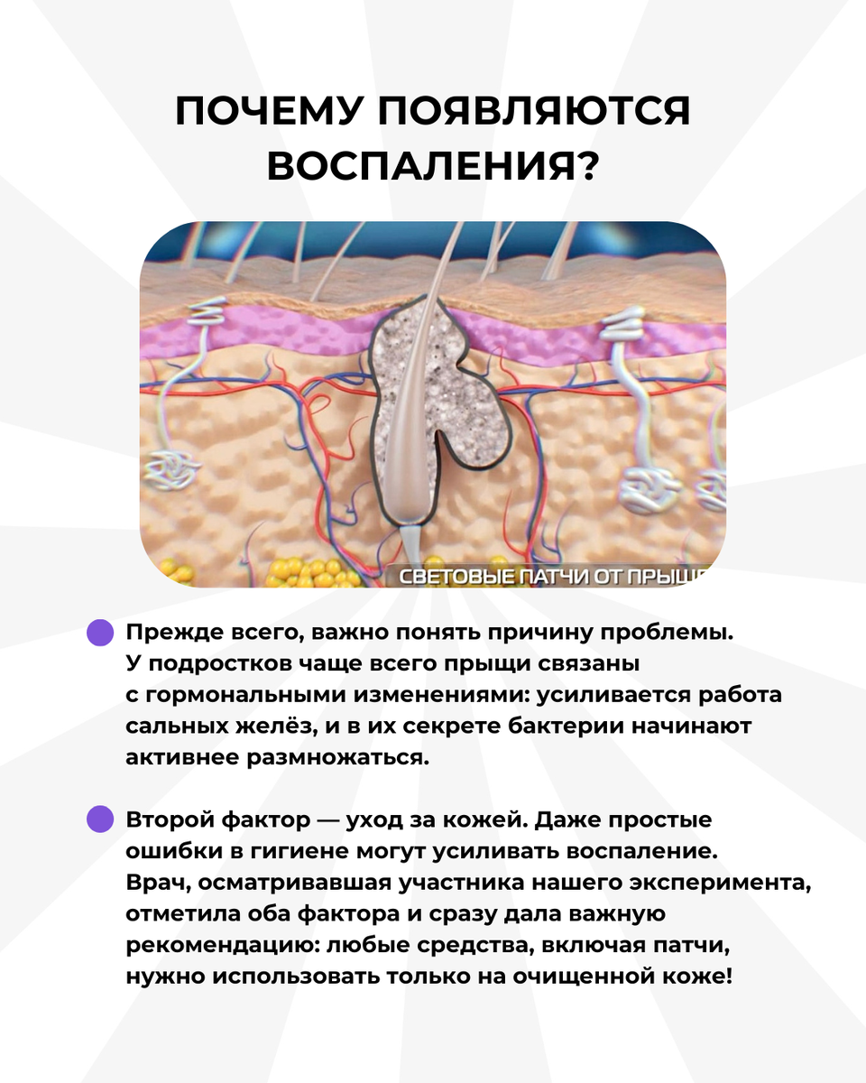 -1-3