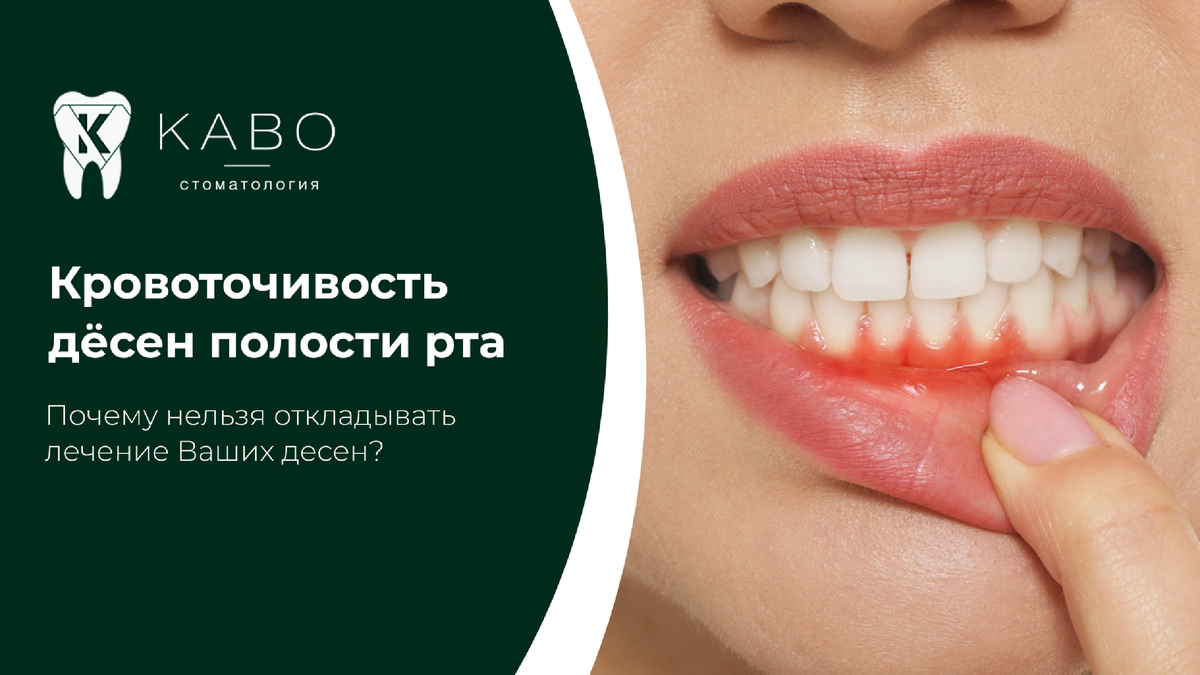 Многие пациенты считают кровоточивость дёсен временной мелочью и не спешат записываться к врачу. Однако даже незначительное появление крови во время чистки зубов может говорить о воспалительном процессе. В стоматологической клинике КАВО в Новороссийске специалисты напоминают: здоровье дёсен напрямую связано с состоянием зубов, прикуса и общим самочувствием человека. Чаще всего причиной кровоточивости становится скопление мягкого налёта и зубного камня. Бактерии раздражают ткани десны, вызывают воспаление, отёк и болезненность. Без лечения проблема постепенно усиливается. Сначала появляется дискомфорт при чистке зубов, затем неприятный запах изо рта, повышенная чувствительность и подвижность зубов. Именно поэтому важно своевременно обратиться в стоматологию Новороссийска и пройти диагностику.  В клинике КАВО лечение начинается с осмотра и оценки состояния пародонта. Врач определяет глубину воспаления, наличие камня, качество домашней гигиены и возможные сопутствующие причины. Иногда кровоточивость связана с неправильным прикусом, скученностью зубов или некачественными пломбами, которые травмируют десну.Специалисты клиники КАВО в Новороссийске рекомендуют проходить профилактический осмотр не реже двух раз в год. Это позволяет обнаружить проблему на ранней стадии и избежать серьёзных осложнений. Чем раньше начато лечение, тем проще восстановить здоровье тканей. Если вы замечаете кровь при чистке зубов, неприятный запах или болезненность дёсен, не откладывайте визит к стоматологу. Своевременная помощь помогает сохранить не только красивую улыбку, но и собственные зубы на долгие годы.  Запись Адрес клиники: Новороссийск Анапское шоссе, 15Д Запись в клинику: 8 (8617) 30-89-65 
