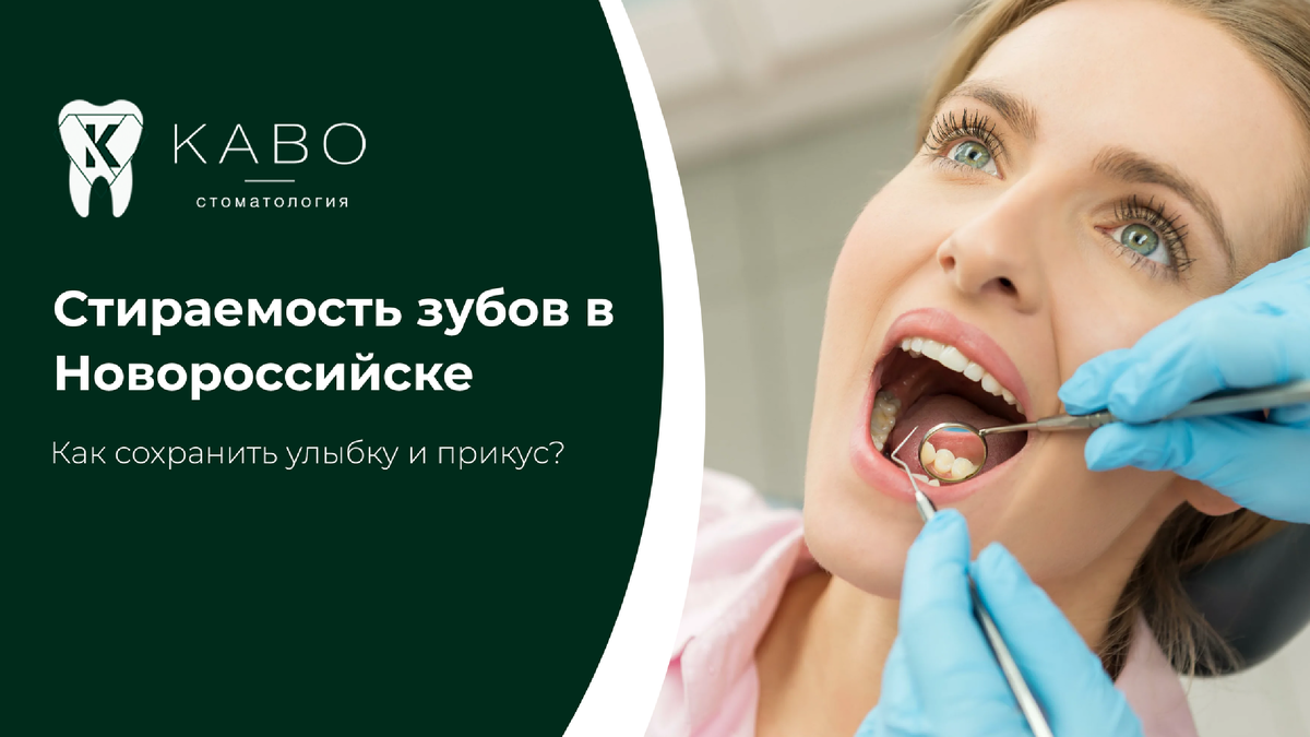Постепенное стирание зубов многие считают естественным возрастным процессом. Но если зубы становятся короче, появляется чувствительность, трещины эмали или меняется форма улыбки, это уже повод обратиться к врачу. В клинике КАВО в Новороссийске проводят диагностику причин стираемости зубов и комплексное восстановление функции.  Стираемость может быть связана с неправильным прикусом, ночным скрежетом зубами, перегрузкой отдельных участков, отсутствием жевательных зубов или привычкой сжимать челюсти в стрессовых ситуациях. Иногда проблема развивается незаметно годами, пока не появляются боли в мышцах лица, щелчки в суставе или сколы эмали.  В стоматологии КАВО в Новороссийске обследование начинается с анализа прикуса, оценки высоты зубов и работы височно-нижнечелюстного сустава. При необходимости применяется цифровая диагностика. Это помогает определить, какие зубы перегружены и почему ткани стираются быстрее нормы. Лечение зависит от причины проблемы. При бруксизме могут использоваться защитные каппы. При нарушении прикуса врач рекомендует ортодонтическую коррекцию. Если зубы уже значительно стерты, проводится восстановление формы с помощью современных реставраций, накладок или коронок. Главная задача — вернуть правильное распределение нагрузки.Если вы замечаете, что зубы стали короче, появились сколы, чувствительность или напряжение в челюсти, запишитесь на консультацию. В клинике КАВО в Новороссийске помогут определить причину стираемости и подобрать современное решение для здоровья и красоты вашей улыбки.  Запись Адрес клиники: Новороссийск Анапское шоссе, 15Д Запись в клинику: 8 (8617) 30-89-65