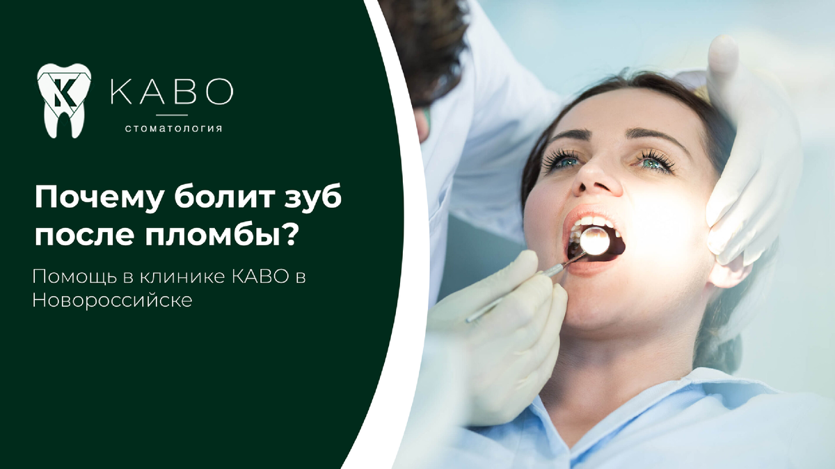 После лечения зуба пациенты иногда ощущают чувствительность или дискомфорт. Это не всегда означает проблему, но требует внимания специалиста. В клинике КАВО в Новороссийске помогают определить причину боли после установки пломбы и быстро восстановить комфорт.  Лёгкая чувствительность в первые дни может быть нормальной реакцией тканей после лечения глубокого кариеса. Зуб адаптируется к новой нагрузке, особенно при контакте с холодным или горячим. Обычно такие ощущения постепенно проходят. Если боль усиливается, появляется при накусывании или не уменьшается через несколько дней, необходимо обратиться в стоматологию Новороссийска. Причиной может быть завышение пломбы, воспаление нерва, микроподтекание под реставрацией или скрытая трещина зуба.  В клинике КАВО врач проводит осмотр, проверяет контакты прикуса и при необходимости делает снимок. Иногда достаточно скорректировать высоту пломбы, чтобы неприятные ощущения исчезли. В более сложных случаях проводится дополнительное лечение. Важно не терпеть боль и не ждать месяцами. Своевременный контроль помогает сохранить зуб и избежать более серьёзного вмешательства. В клинике КАВО в Новороссийске каждому пациенту подробно объясняют, какие ощущения допустимы после лечения, а какие требуют повторного визита.  Если зуб после пломбы мешает жевать или реагирует на нагрузку, запишитесь на осмотр. Быстрая коррекция позволит вернуть комфорт и сохранить результат лечения.  Запись Адрес клиники: Новороссийск Анапское шоссе, 15Д Запись в клинику: 8 (8617) 30-89-65