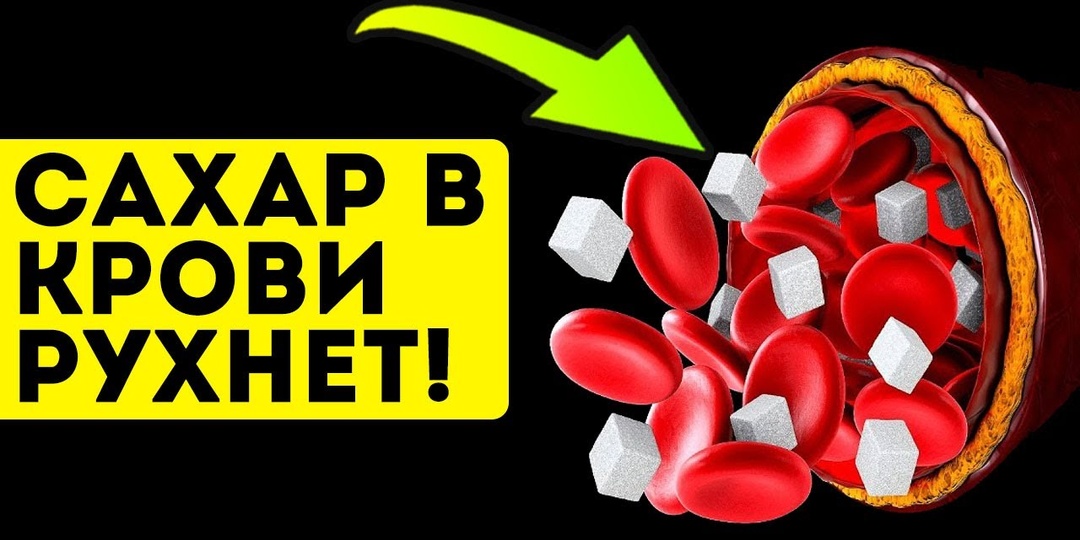 КАК БЫСТРО СНИЗИТЬ САХАР В КРОВИ — утренние действия, которые могут повлиять на показатели