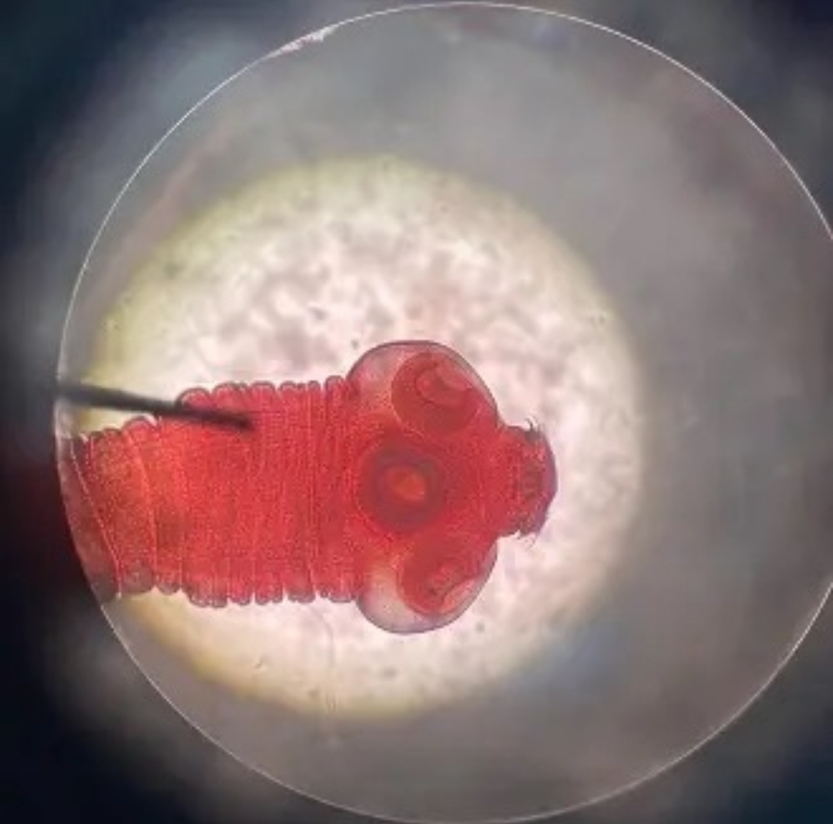 Фото ленточного гельминта Taenia solium (свиной цепень). Источник: https://www.smclinic.ru/diseases/tenioz/?utm_referrer=https%3A%2F%2Fwww.google.com%2F