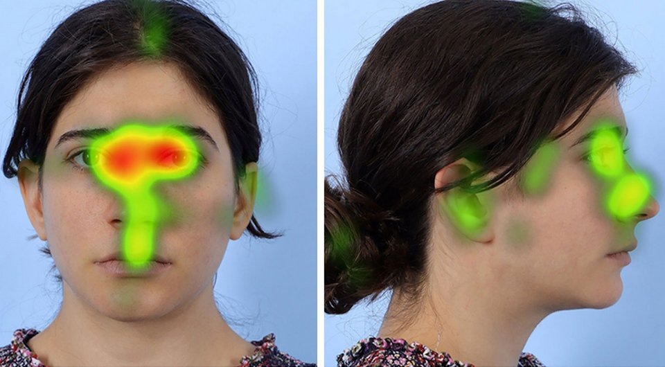   Bradley A. Melnick et al. / Plastic and Reconstructive Surgery, 2026