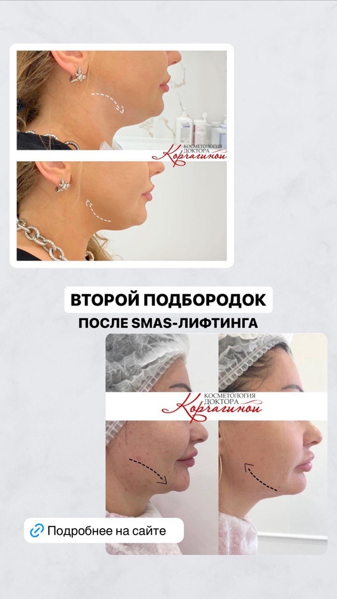 Комбинация методов - лучшее решение.