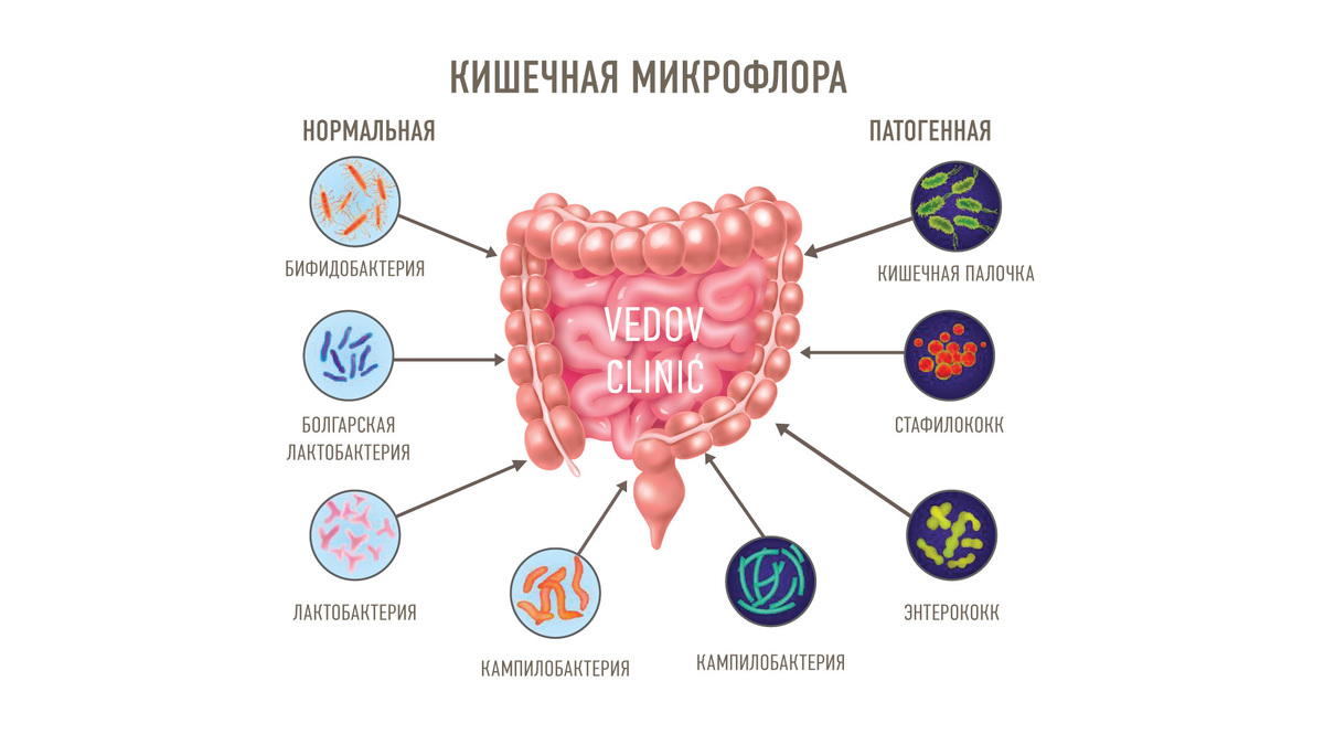 Микрофлора кишечника