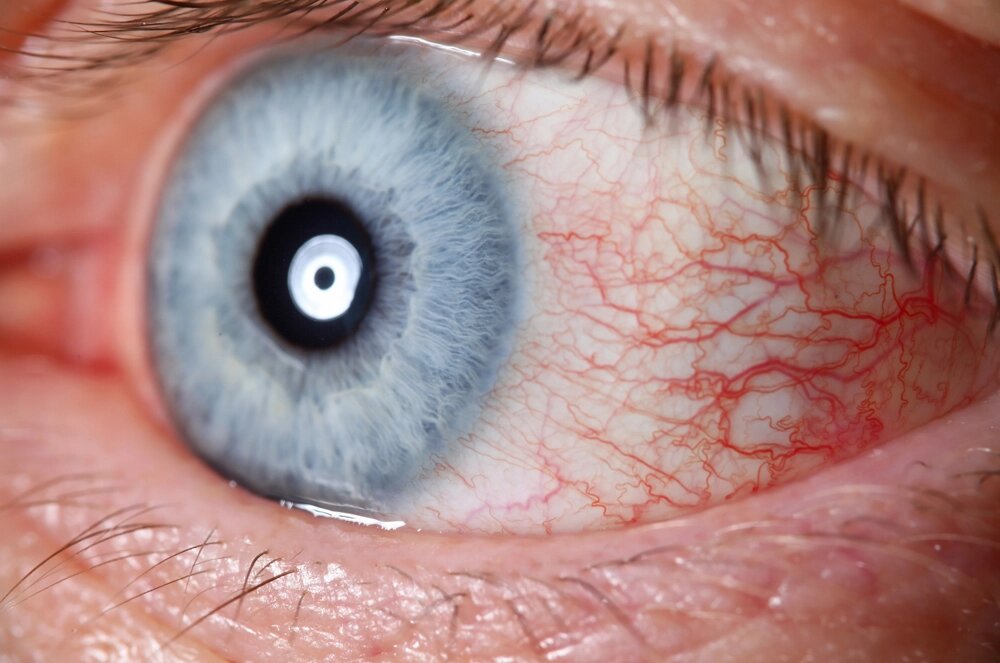    Фото: istockphoto.com