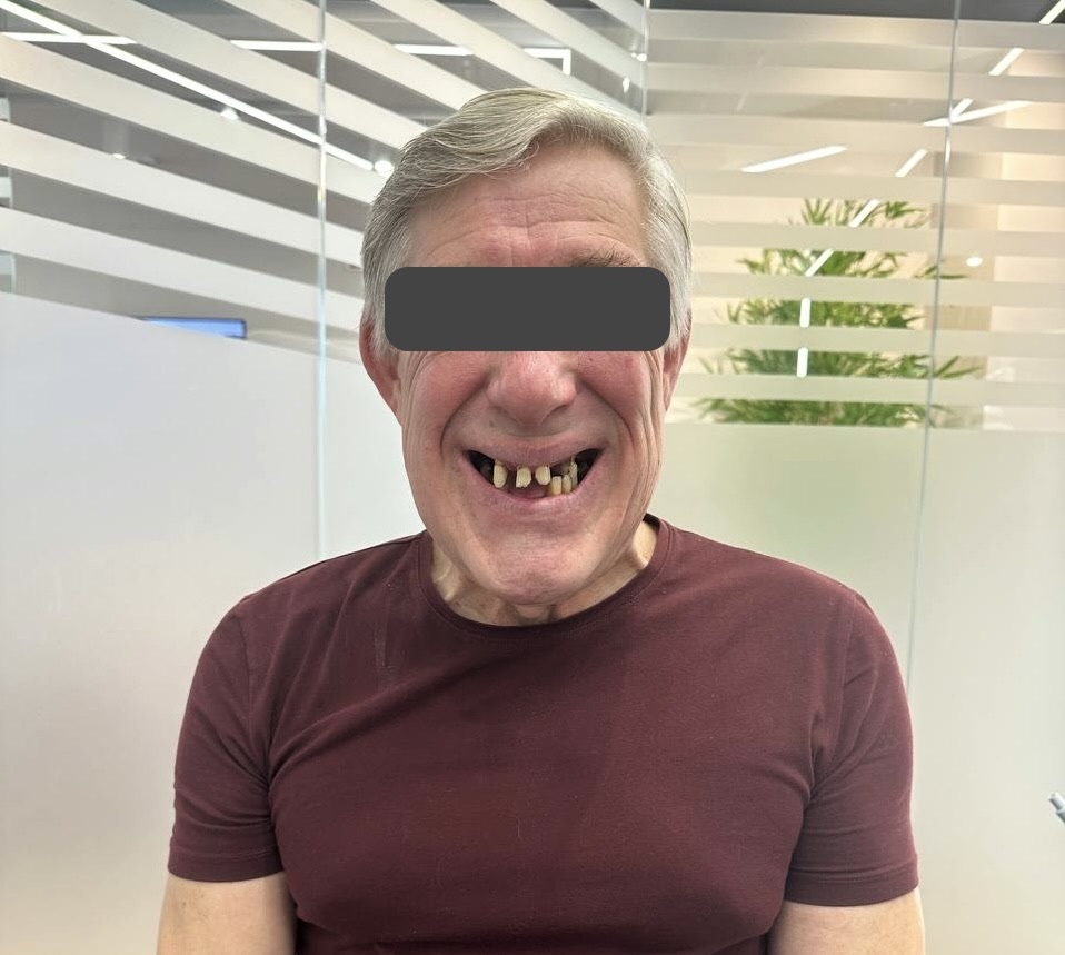 Наш пациент до