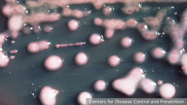     Фото: Centers for Disease Control and Prevention   
 Текст: Тимур Шайдуллин