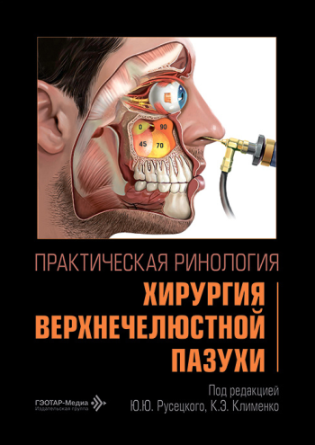 Практическая ринология. Хирургия верхнечелюстной пазухи