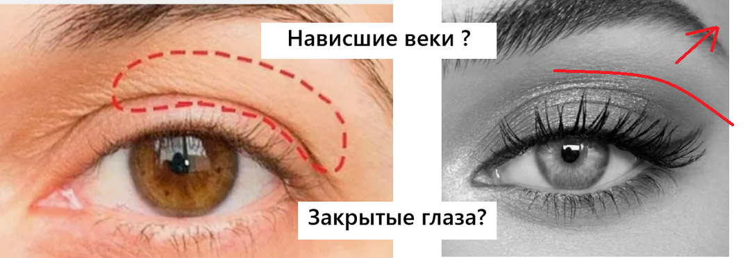 Никаких дряблых век и полуоткрытых глаз с нависшими веками: сделайте 3 действия и откройте глаза