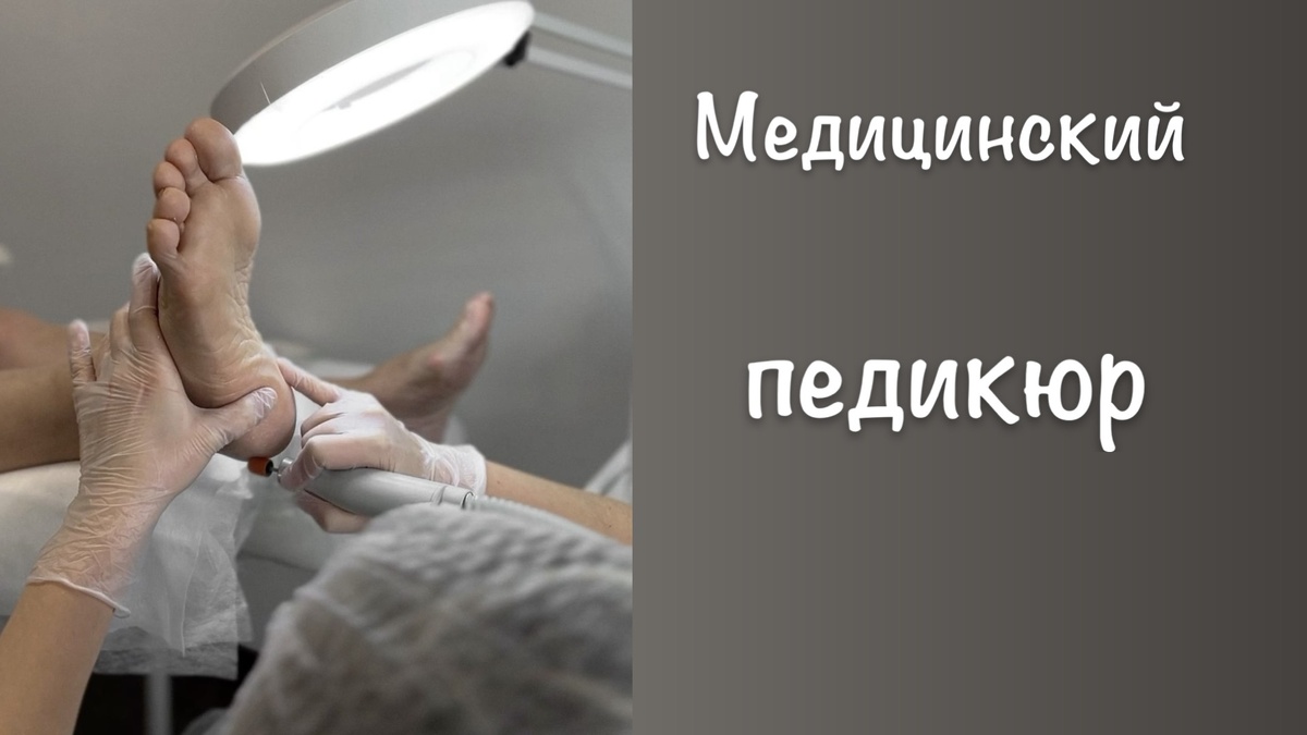 Медицинский педикюр

Медицинский педикюр — это раздел клинической медицины, занимающийся диагностикой, лечением и профилактикой заболеваний стоп и ногтевых пластин. В отличие от косметического (эстетического) аналога, данная процедура направлена не на нанесение декоративного покрытия, а на восстановление физиологической функции стопы, купирование болевого синдрома и устранение патологических образований.

Его могут выполнять только медики.

В него включается:

· лечение грибка (онихомикоз/микоз),
· вросших ногтей (онихокриптоз),
· стержневых мозолей, обычных мозолей, натоптышей (гиперкератоз),
· трещин стоп,
· бородавок (ВПЧ/вирус папилломы человека),
· подногтевых гематом и травм ногтей — без боли и хирургического вмешательства, т. е. малоинвазивным способом: аппаратная обработка, коррекционные системы и медикаментозная терапия с профилактикой рецидивов.

Концепция базируется на принципах доказательной медицины: вмешательство проводится только при наличии показаний, с использованием стерильного хирургического инструментария и фармакологических препаратов.

Что такое медицинский педикюр?

Медицинский педикюр — лечебная и профилактирующая процедура с медицинской подготовкой специалиста, стерильным инструментом и аппаратными технологиями. Часто в этой процедуре используют инструменты из сферы стоматологии. Назначают её при онихомикозе, вросших ногтях, гиперкератозе и диабетической стопе, а также людям, проходящим лечение по онкологии, так как из-за их пониженного иммунитета у них есть осложнения в виде присоединения инфекции (грибка ногтей и стоп) — там, где обычный уход не даёт результата.

