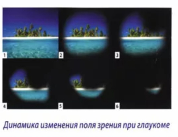 Изображение из Яндекс картинки 