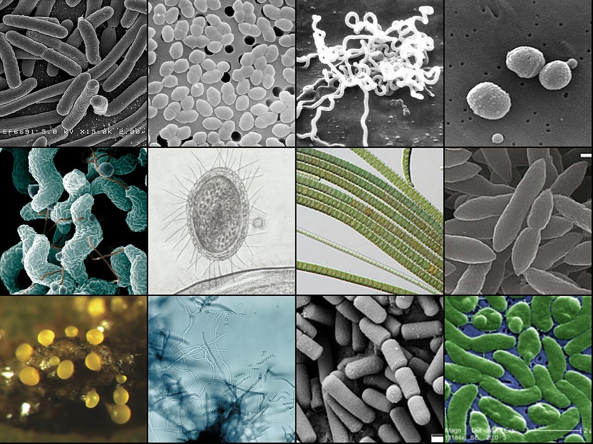 Разнообразие бактерий. Источник ихображения https://upload.wikimedia.org/wikipedia/commons/4/4f/Bacteria_collage.jpg
