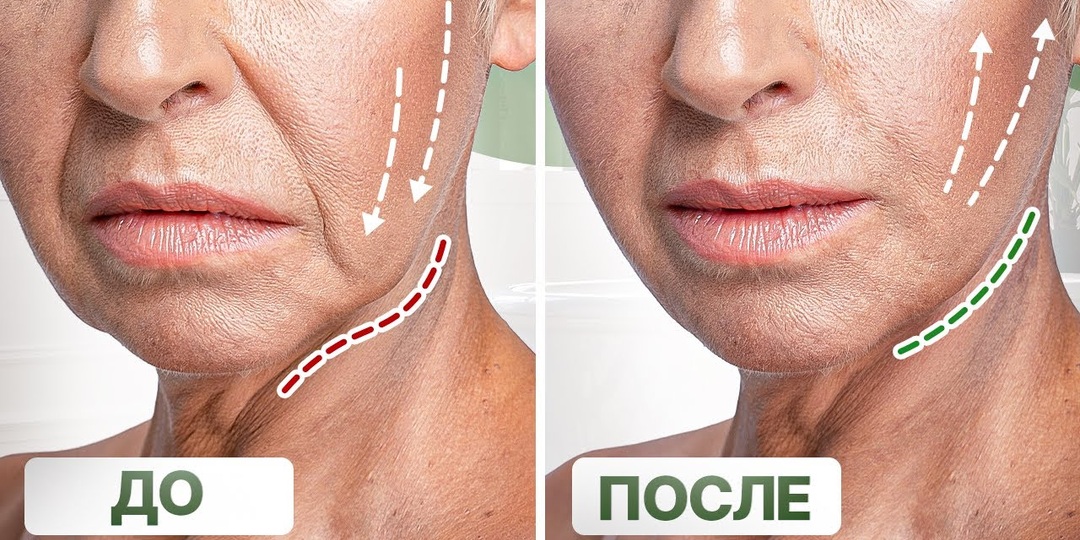 Косточка на ноге, сутулость и «поплывший» овал лица — это звенья одной цепи. Вот что на самом деле происходит с телом
