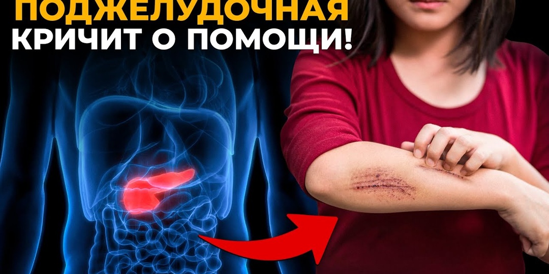 Какие Симптомы Могут Говорить О Проблемах С Поджелудочной