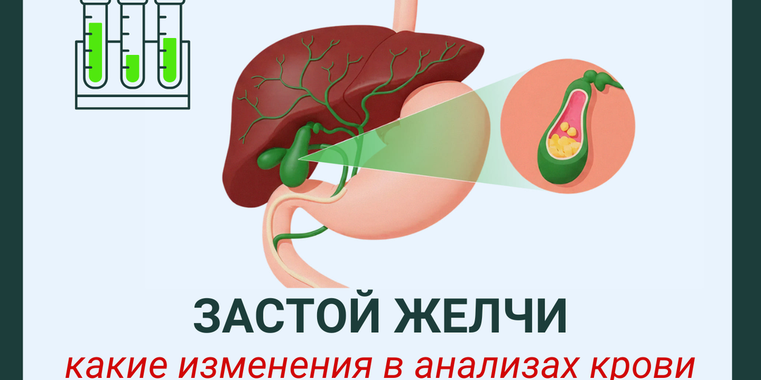 Застой желчи: какие изменения в анализах крови нельзя игнорировать