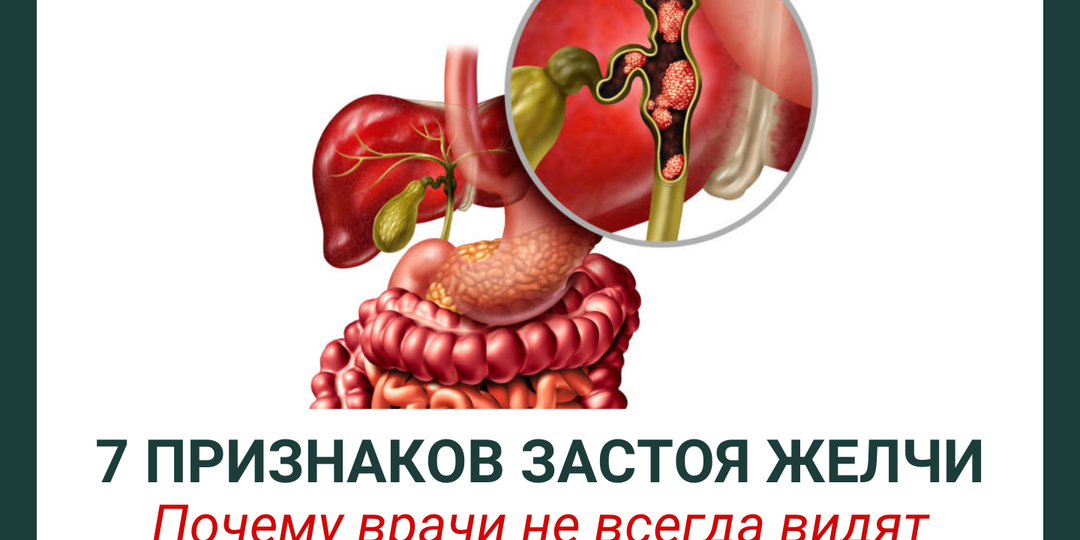 Почему врачи не всегда видят проблему? 7 признаков застоя желчи
