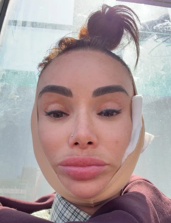 -2