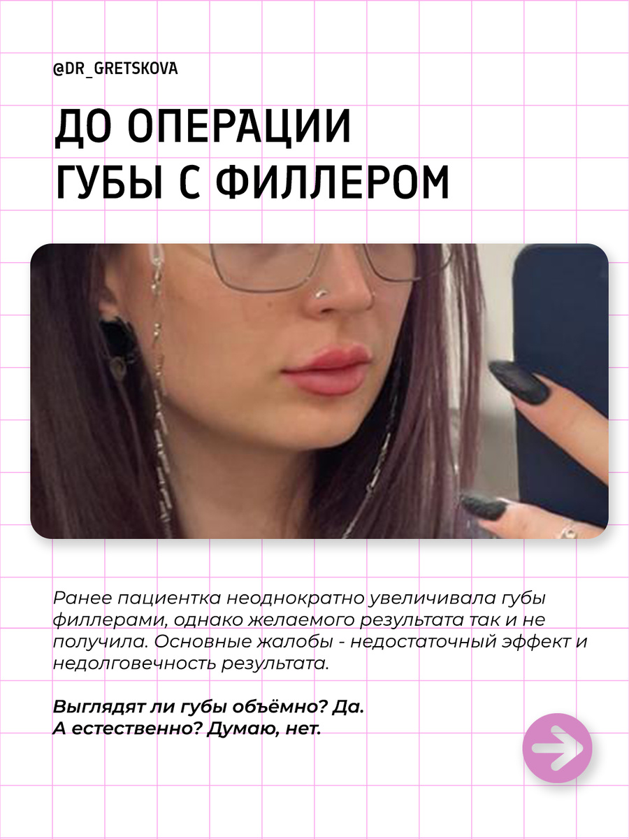 -1-2