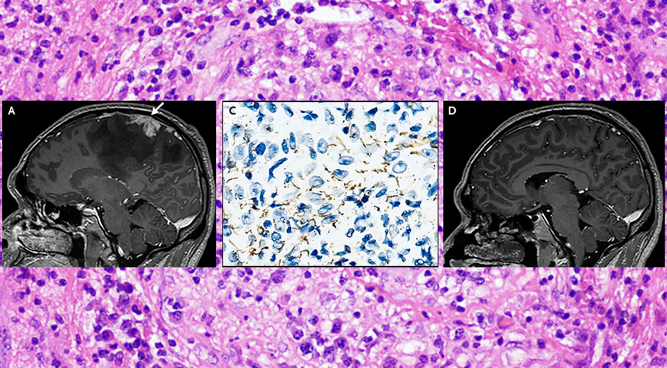   N + 1; Ke Xiao, Ying Si / NEJM, 2026