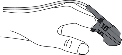 Fig. 2. SpO2  sensor placement