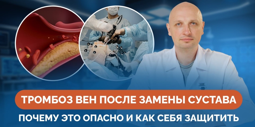 Тромбоз вен после замены сустава: почему это опасно и как себя защитить