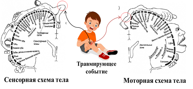 Рисунок 1. Долговременное отражение травмирующего события у ребенка в сенсорной и моторной схеме тела