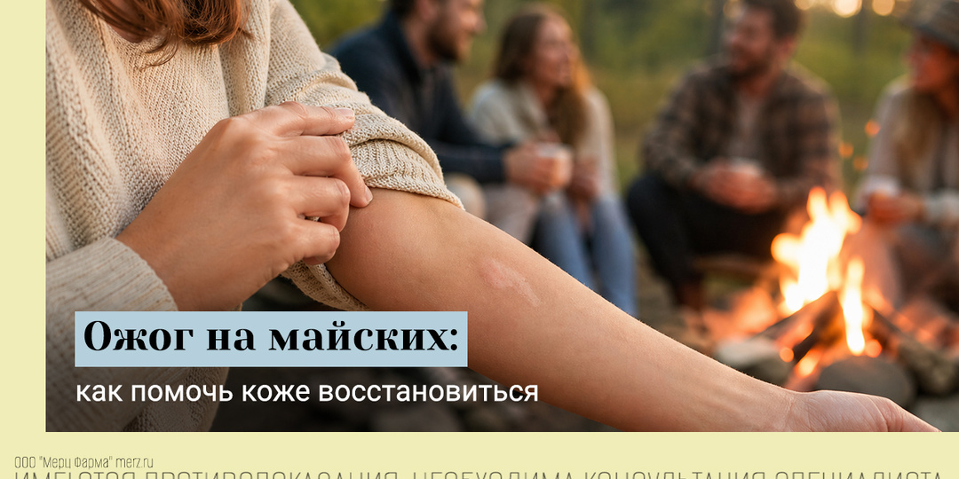 Майский травматизм: ожог у костра. Как помочь, если появился шрам