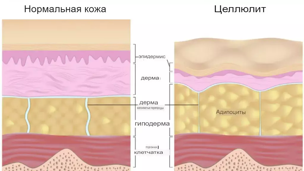 Изображение взято с сайта https://prodex.ru