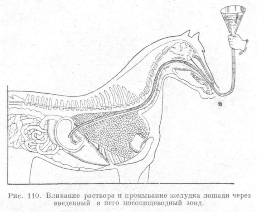 Рис.2. Пример носопищеводного зонда