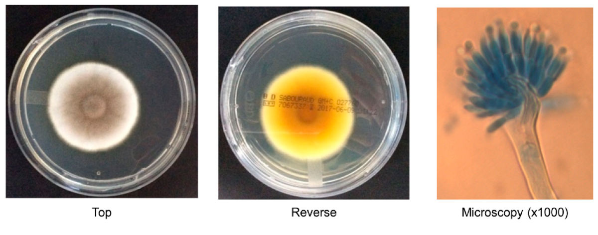 
Грибок Aspergillus calidoustus под микроскопом — тот самый "безбилетник" из чистых помещений NASA. Видны цепочки спор-конидий, с помощью которых он размножается и распространяется. Именно эти споры оказались настолько живучими, что выдержали почти все имитированные марсианские условия.
Источник: thunderhouse4-yuri.blogspot.com