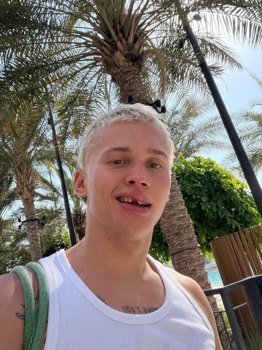 -2
