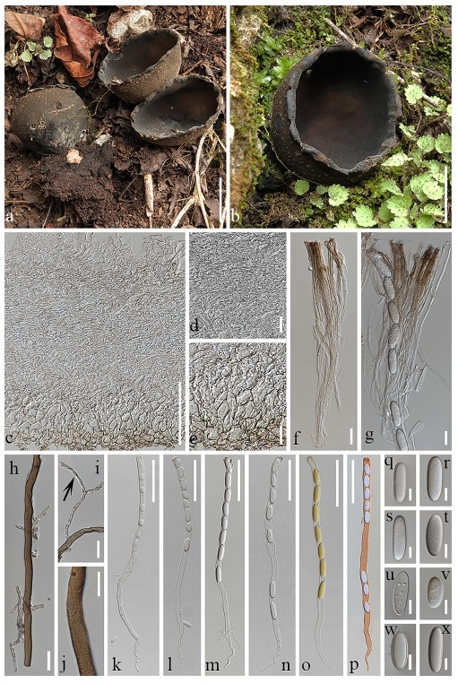 FIGURE 3. Urnula subcrateria (Holotype: HKAS 129214). a, b fresh specimens in the field; c excipulum; d medullary excipulum; e ectal
excipulum; f paraphyses; g paraphyses and asci; h external hairs; i type 1 of external hairs indicated by the arrow; j type 2 of external hairs;
k–p asci with ascospores, q–x ascospores. Bars: a = 2.5 cm; b = 2 cm; c, k–p= 100 μm; d–i= 20 μm; j, q–x = 10 μm.