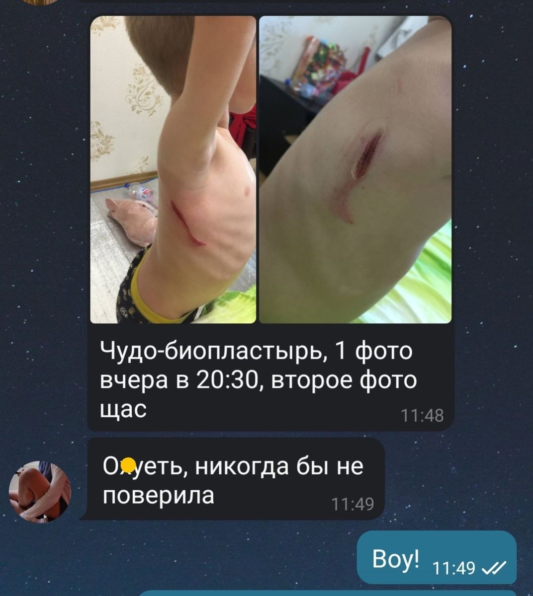 -2