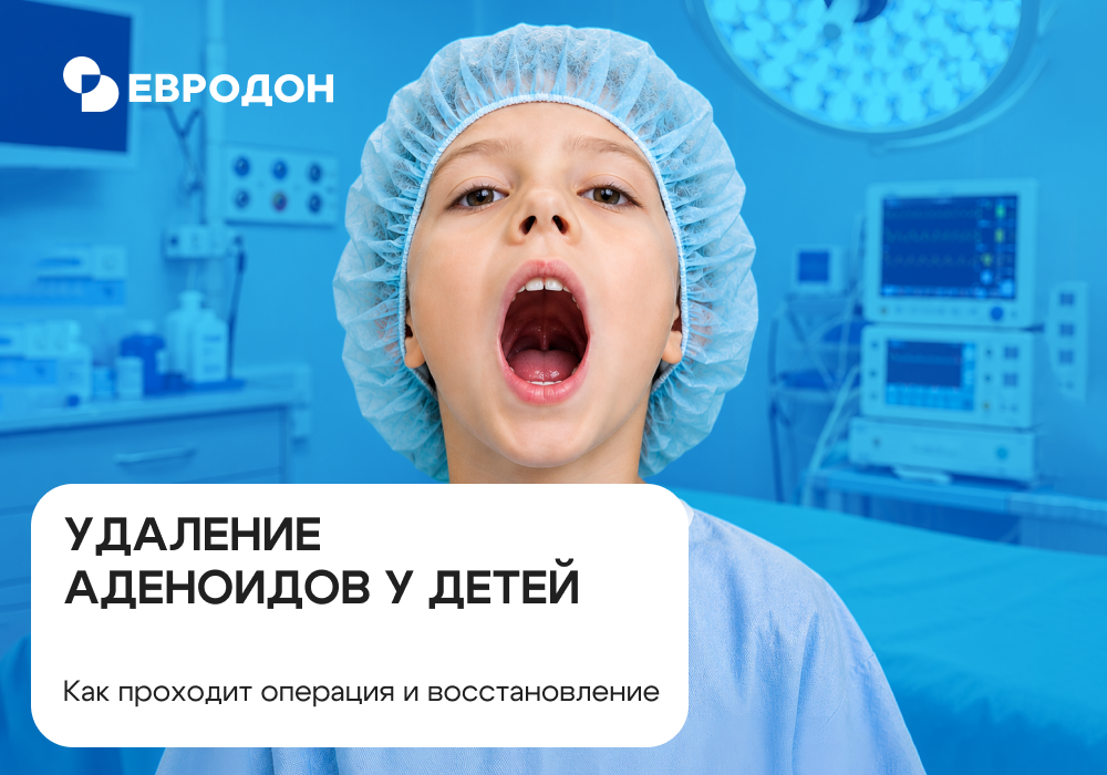 Удаление аденоидов - https://eurodon61.ru/about/articles/udalenie-adenoidov-u-detey-kak-prokhodit-operatsiya-i-vosstanovlenie/ 
