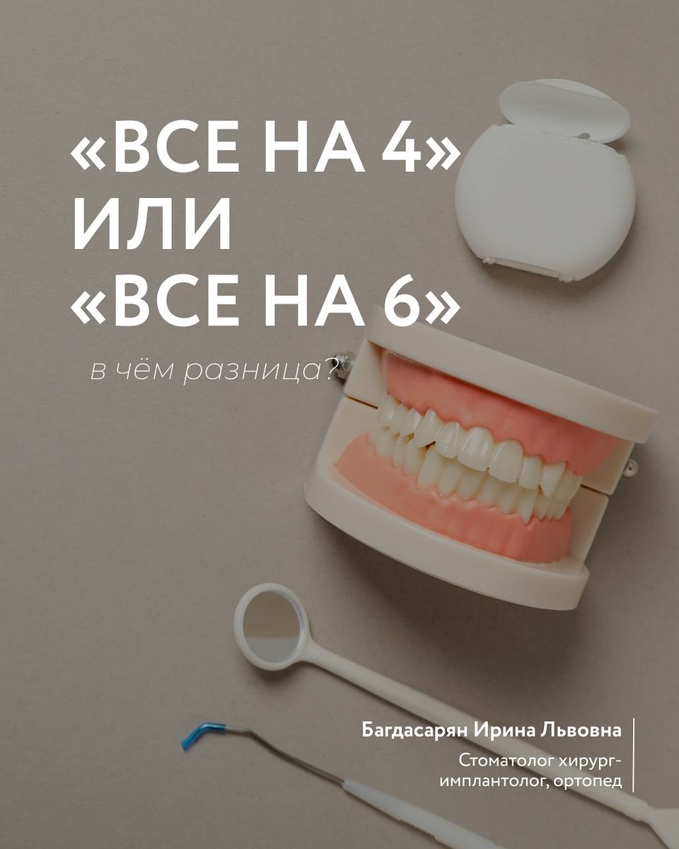 «Все на 4» или «все на 6», в чем разница?